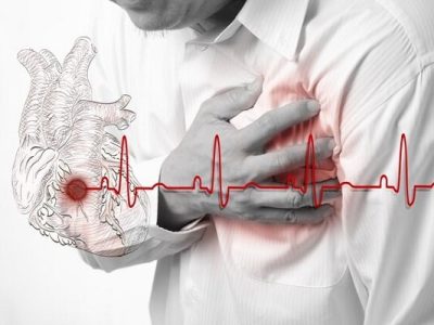 استرس باعث بیماری قلبی می‌شود